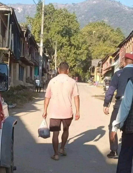 श्रीामानले आफ्नै श्रीमतीकाे टाउकाे छिनाए